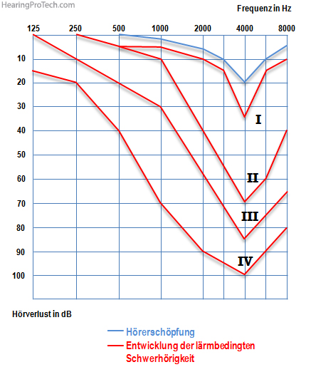 Veränderung der lärmbedingten Schwerhörigkeit