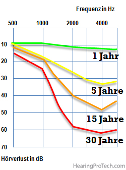 Veränderung des Hörvermögens eines Arbeitnehmers, der während eines Zeitraums von 30 Jahren einem Lärmpegel von 95 dB(A) ausgesetzt ist. 